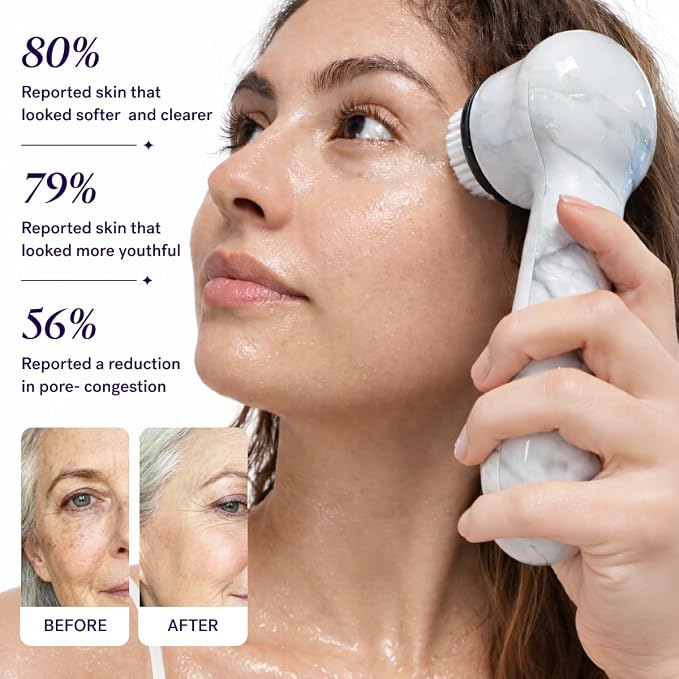Michael Todd Beauty Soniclear Allure 2026 Readers Choice Winner Sonic (no Rotating) Facial Cleansing + Exfoliation Brush for Men/Women, Antimicrobial Protected Bristles, 4 speeds, Serum Infusion Head