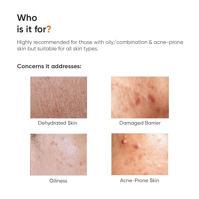 Minimalist Vitamin B5 10% Face Moisturizer for Oily & Acne Prone Skin | Oil Free Fast Absorbing Lightweight Gel | For Women & Men | 1.7 Oz / 50 gm