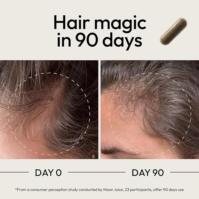 Moon Juice スーパーヘアー 育毛ビタミン剤 男女兼用 ビオチン＆ノコギリヤシ配合 - 臨床効果が証明されたマルチビタミンヘアサプリメント 健康で強い豊かな髪へ 120カプセル 30回分