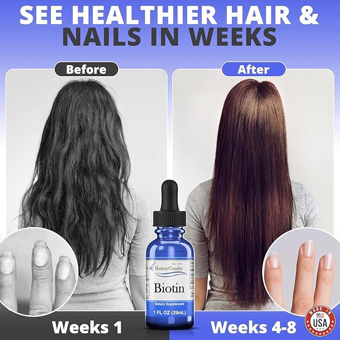 B7 Drops 500% DV Biotin, Hair and Nails Vitamins for Women, Men, and Kids, Sublingual Biotin Liquid for Healthy Skin, 36 Serving Bottle, Made In USA