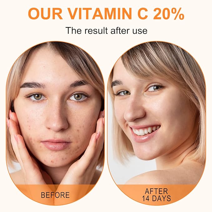 Sérum Premium à 20% de Vitamine C pour le Visage avec Acide Hyaluronique, Rétinol et Acides Aminés - Stimule le Collagène Cutané, Hydrate et Repulpe la Peau, Sérum Anti-Âge et Anti-Rides 60 ml