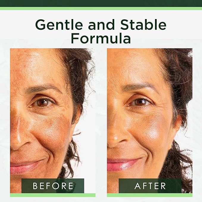 Sérum à la Niacinamide et Vitamine B3 de Tree of Life Beauty, Huile Hydratante pour le Visage contre les Taches Brunes et de Vieillesse, Resserre les Pores, Sérums Visage pour Peaux Sensibles à l'Acide Hyaluronique et Vitamine E, 60 ml